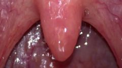 Throat And Uvula Close Up