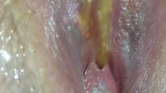 Close Up Of My Girlfriends Piss Hole