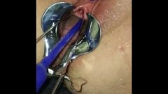 Brutal Chick Urethral Sounding. Wet & Messy Close Up Pissing