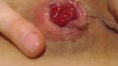 Rectal And Gape Close Up
