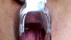 Cervix View And Twat Gaping